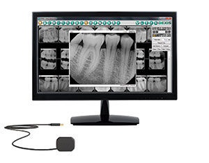 DXP Monitor Sensor | Oral Health | Dallas Prosthodontist | Dr. Kathia Steel DDS, MS, PA